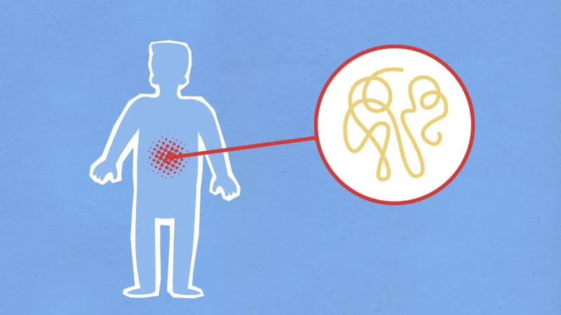 The Gut-Brain Connection and Sertraline: How Your Digestive Health May Be Shaping Your Treatment Outcomes